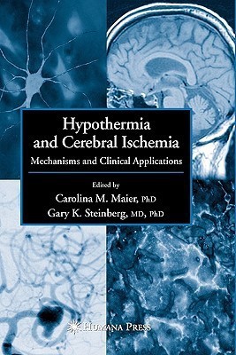 Hypothermia and Cerebral Ischemia(English, Paperback, unknown)