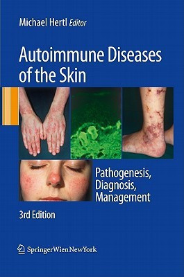 Autoimmune Diseases of the Skin(English, Hardcover, unknown)