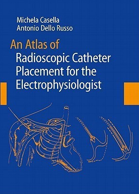 An Atlas of Radioscopic Catheter Placement for the Electrophysiologist(English, Hardcover, unknown)