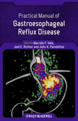 Practical Manual of Gastroesophageal Reflux Disease(English, Paperback, unknown)