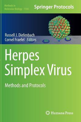 Herpes Simplex Virus(English, Hardcover, unknown)