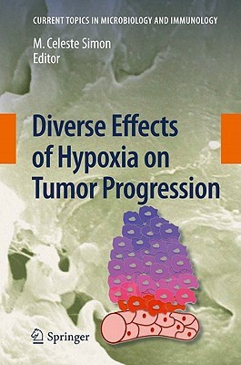 Diverse Effects of Hypoxia on Tumor Progression(English, Hardcover, unknown)