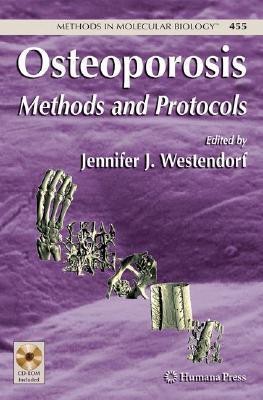 Osteoporosis 1 HAR/CDR Edition(English, Hardcover, unknown)