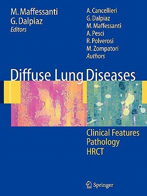 Diffuse Lung Diseases(English, Paperback, unknown)
