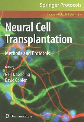 Neural Cell Transplantation(English, Hardcover, unknown)