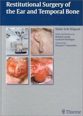 Restitutional Surgery of the Ear and Temporal Bone 1st Edition(English, Hardcover, Malte Erik Wigand)