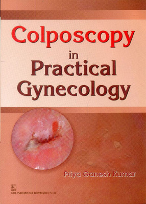 Colposcopy in Practical Gynecology(English, Paperback, Priya Ganesh Kumar)