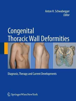 Congenital Thoracic Wall Deformities(English, Hardcover, unknown)