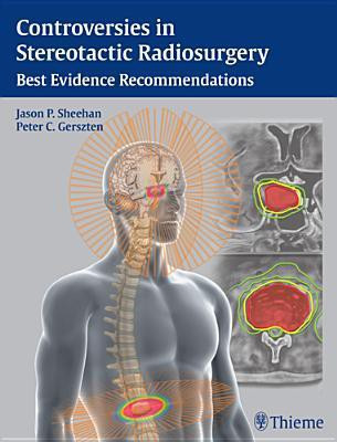 Controversies in Stereotactic Radiosurgery(English, Hardcover, unknown)