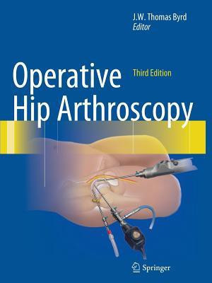 Operative Hip Arthroscopy(English, Paperback, unknown)