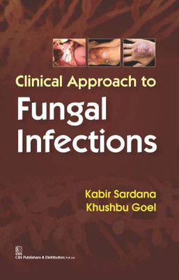 Clinical Approach to Fungal Infections(English, Paperback, Kabir Sardana)
