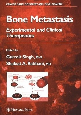 Bone Metastasis(English, Paperback, unknown)