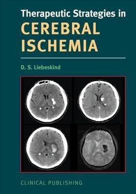 Cerebral Ischemia(English, Hardcover, unknown)