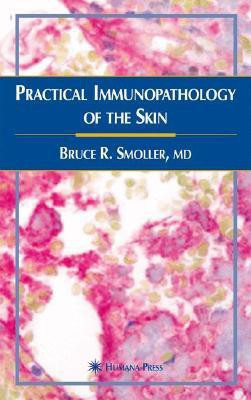 Practical Immunopathology of the Skin illustrated edition Edition(English, Hardcover, Smoller Bruce R.)