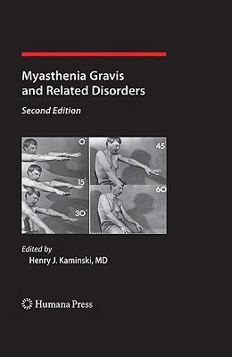 Myasthenia Gravis and Related Disorders 2 2nd  Edition(English, Hardcover, unknown)
