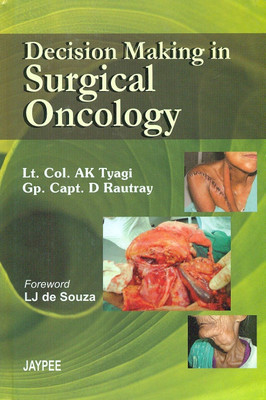 DECISION MAKING IN SURGICAL ONCOLOGY 1st Edition(English, Hardcover, TYAGI)