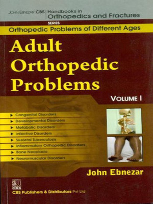 John Ebnezar CBS Handbooks in Orthopedics and Factures: Vol. 1(English, Paperback, Ebnezar John)
