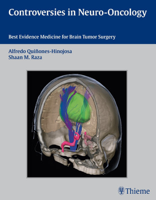 Controversies in Neuro-Oncology(English, Hardcover, unknown)