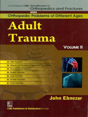 John Ebnezar CBS Handbooks in Orthopedics and Factures: v. 2(English, Paperback, Ebnezar John)