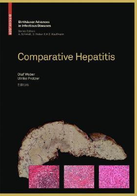 Comparative Hepatitis(English, Hardcover, unknown)