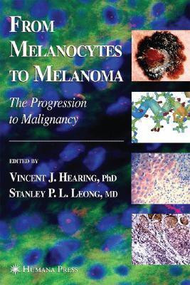 From Melanocytes to Melanoma illustrated edition Edition(English, Hardcover, unknown)