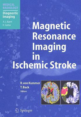 Magnetic Resonance Imaging in Ischemic Stroke(English, Hardcover, unknown)