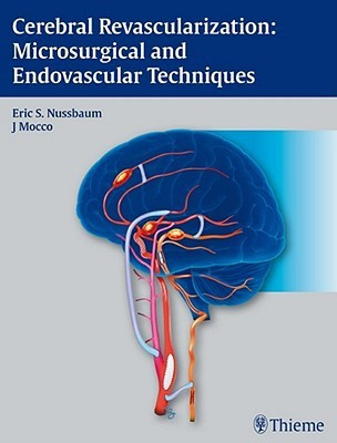 Cerebral Revascularization: Microsurgical and Endovascular Techniques 1st Edition(English, Hardcover, unknown)