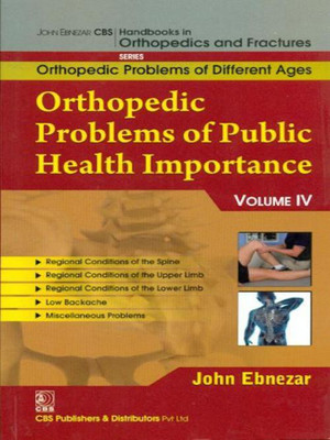 John Ebnezar CBS Handbooks in Orthopedics and Factures: Vol. 4(English, Paperback, Ebnezar John)
