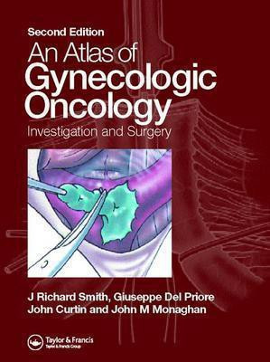 Atlas of Gynecologic Oncology(English, Hardcover, unknown)