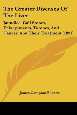 The Greater Diseases Of The Liver(English, Paperback, Burnett James Compton)
