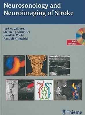 Neurosonology and Neuroimaging of Stroke(English, Hardcover, Valdueza Jose M.)