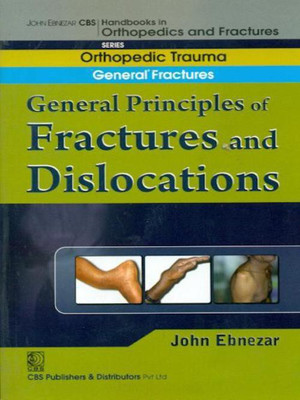 John Ebnezar CBS Handbooks in Orthopedics and Factures 1st Edition(English, Paperback, Ebnezar John)