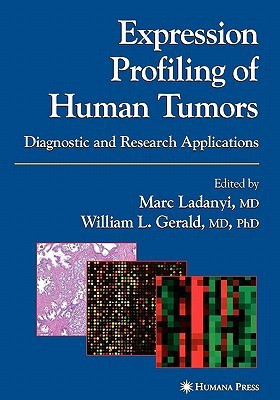 Expression Profiling of Human Tumors(English, Paperback, unknown)