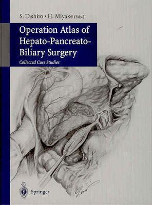 Operation Atlas of Hepato-Pancreato-Biliary Surgery(English, Hardcover, unknown)
