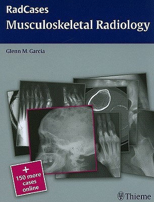 Radcases Musculoskeletal Radiology 1 Pap/Psc Edition(English, Paperback, unknown)