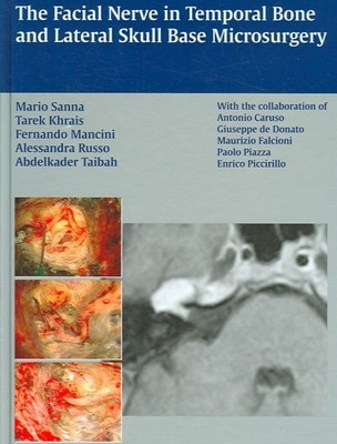 Facial Nerve in Temporal Bone and Lateral Skull Base Microsurgery(English, Hardcover, Sanna Mario)