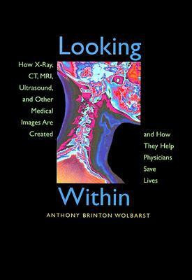 Looking Within 1st Edition(English, Paperback, Wolbarst Anthony Brinton)