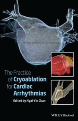 The Practice of Catheter Cryoablation for Cardiac Arrhythmias(English, Hardcover, unknown)