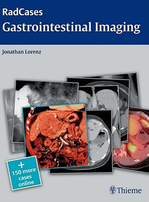 Radcases Gastrointestinal Imaging(English, Paperback, Lorenz Jonathan M.)
