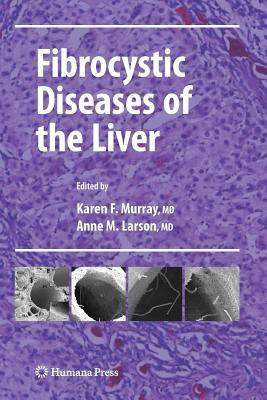 Fibrocystic Diseases of the Liver(English, Paperback, unknown)