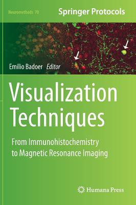 Visualization Techniques(English, Hardcover, unknown)