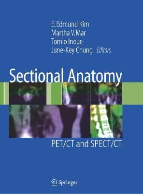 Sectional Anatomy 1st Edition(English, Hardcover, unknown)