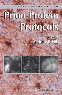 Prion Protein Protocols 1st Edition(English, Hardcover, unknown)