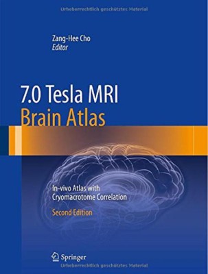 7.0 Tesla MRI Brain Atlas(English, Hardcover, unknown)