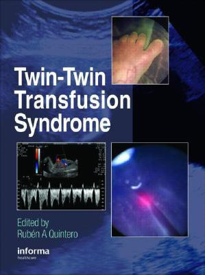 Twin-Twin Transfusion Syndrome(English, Hardcover, unknown)
