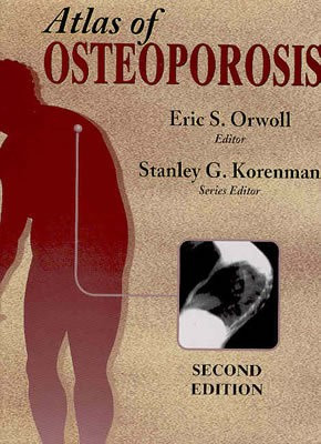 Atlas of Osteoporosis(English, Hardcover, unknown)