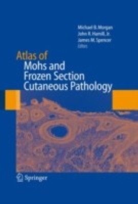 Atlas of Mohs and Frozen Section Cutaneous Pathology 1st Edition. Edition(English, Hardcover, unknown)