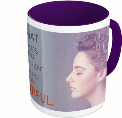 

MiiCreations Printed Two Tone Blue And White What Makes You Different, Makes You Beautiful Ceramic Mug(325 ml)