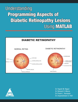 Understanding Programming Aspects of Diabetic Retinopathy Lesions Using MATLAB(English, Paperback, Dr. Pravin L. Yannawar, Dr. Ramesh R. Manza, Yogesh M. Rajput, Dnyaneshwari D. Patil,)