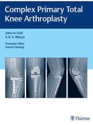 Complex Primary Total Knee Arthroplasty - 1E(English, Hardcover, Marya)